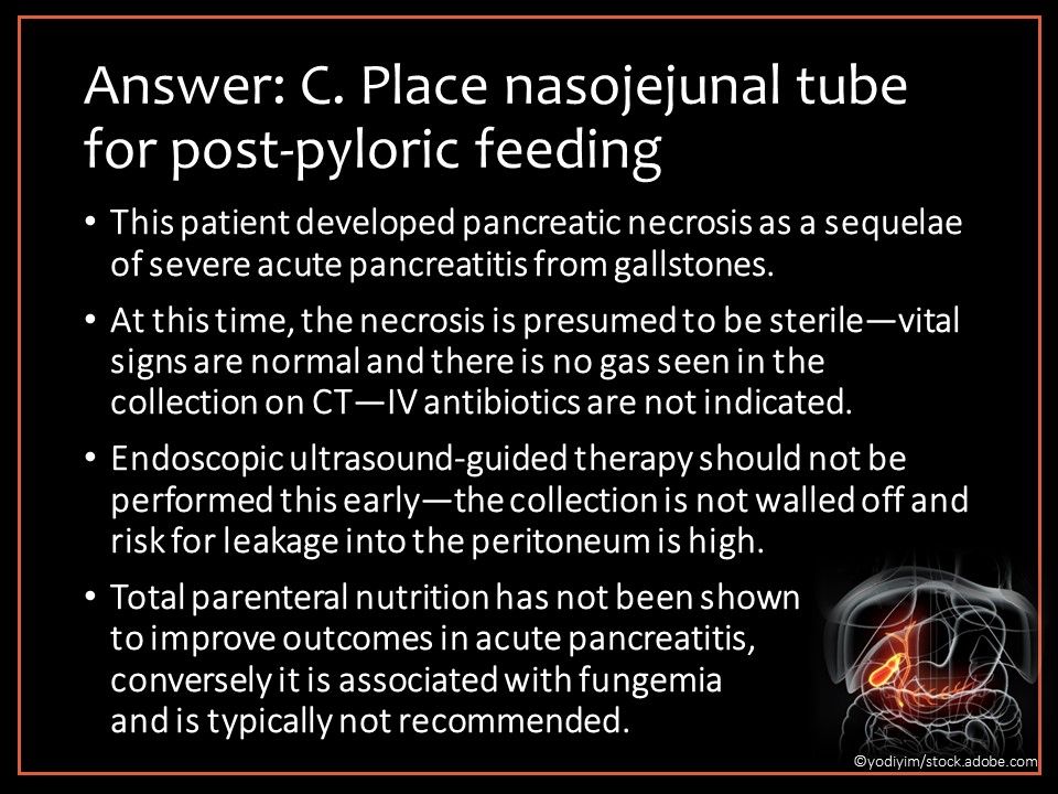 Pancreatic necrosis, nasojejunal feeding, post-pyloric tube