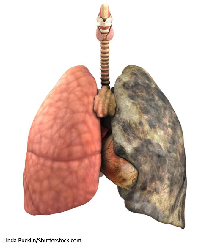 Prognostic Power of the BCSS in Severe COPD