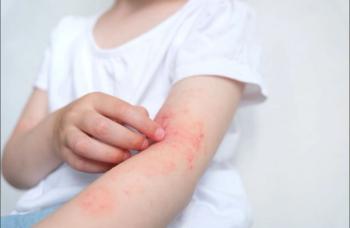 Dupilumab is Safe and Effective Across Pediatric Populations with Severe Atopic Dermatitis: New Meta-Analysis