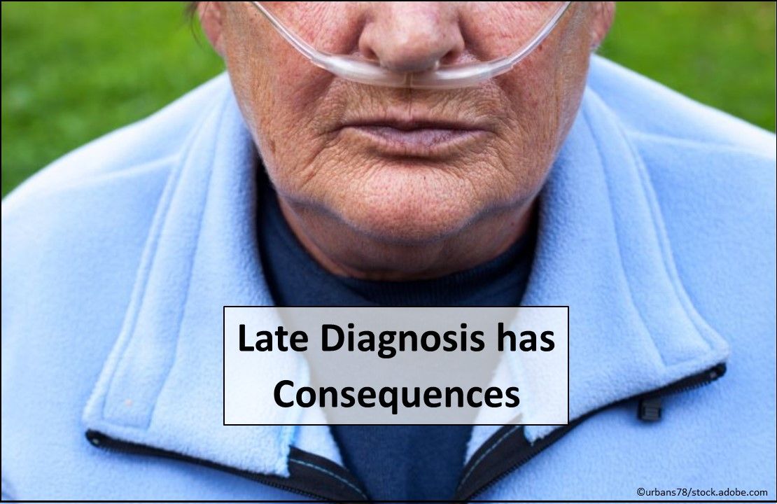 COPD, COPD research, late COPD diagnosis, COPD exacerbation, primary care