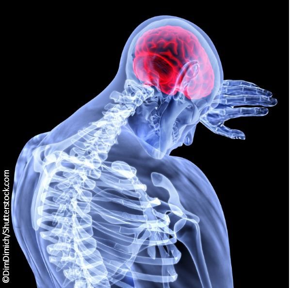 ©DimDimich/Shutterstock.com 