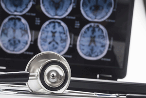 Getting to answers about Biogen’s Aduhelm