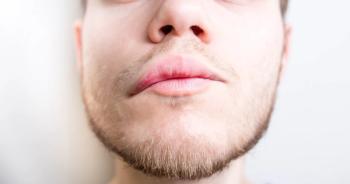 Image credit: velimir | stock.adobe.com