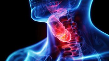 Depiction of esophageal cancer | Image Credit: © kamonrat - stock.adobe.com