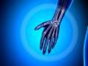 Rheumatoid Arthritis Drug Effective for Early Treatment