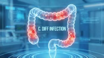 Medical illustration of Clostridioides difficile infection in the human colon | Image Credit: DavoeAnimation | stock.adobe.com