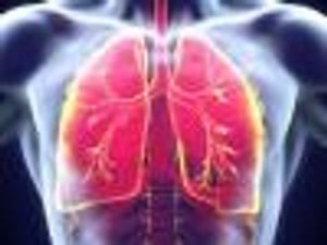 Childhood Pneumonia Carries Adult COPD Risk