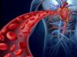 Rheumatoid Arthritis Linked to Heart Disease Risk