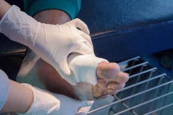 foot infected wound - Image credit: kirov1969 | stock.adobe.com