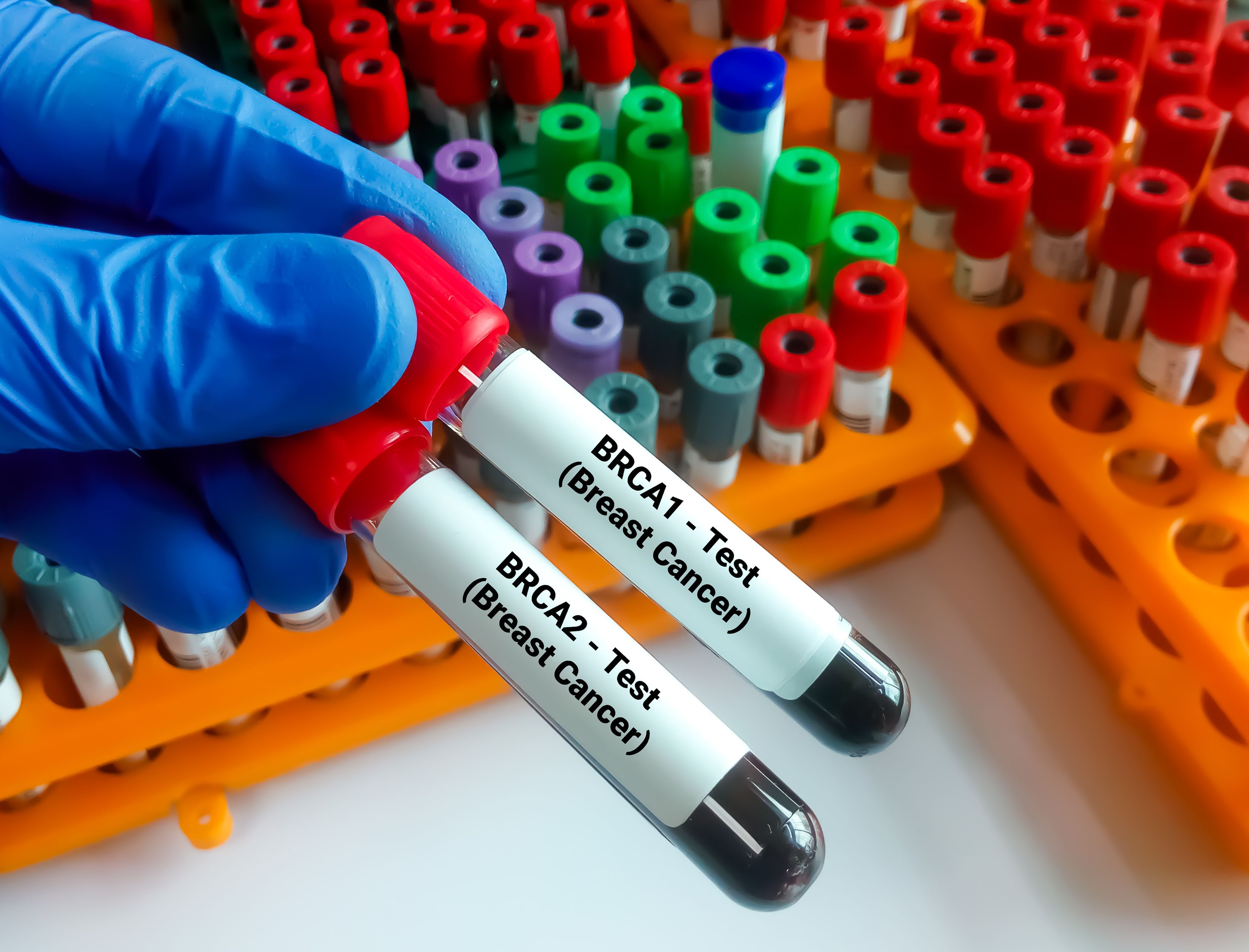 Samples with BRCA1 and BRCA2 mutations | Image Credit: © Saiful52 - stock.adobe.com