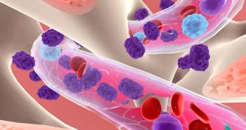 Chronic Myeloid Leukemia | Image Credit: cramedical - stock.adobe.com