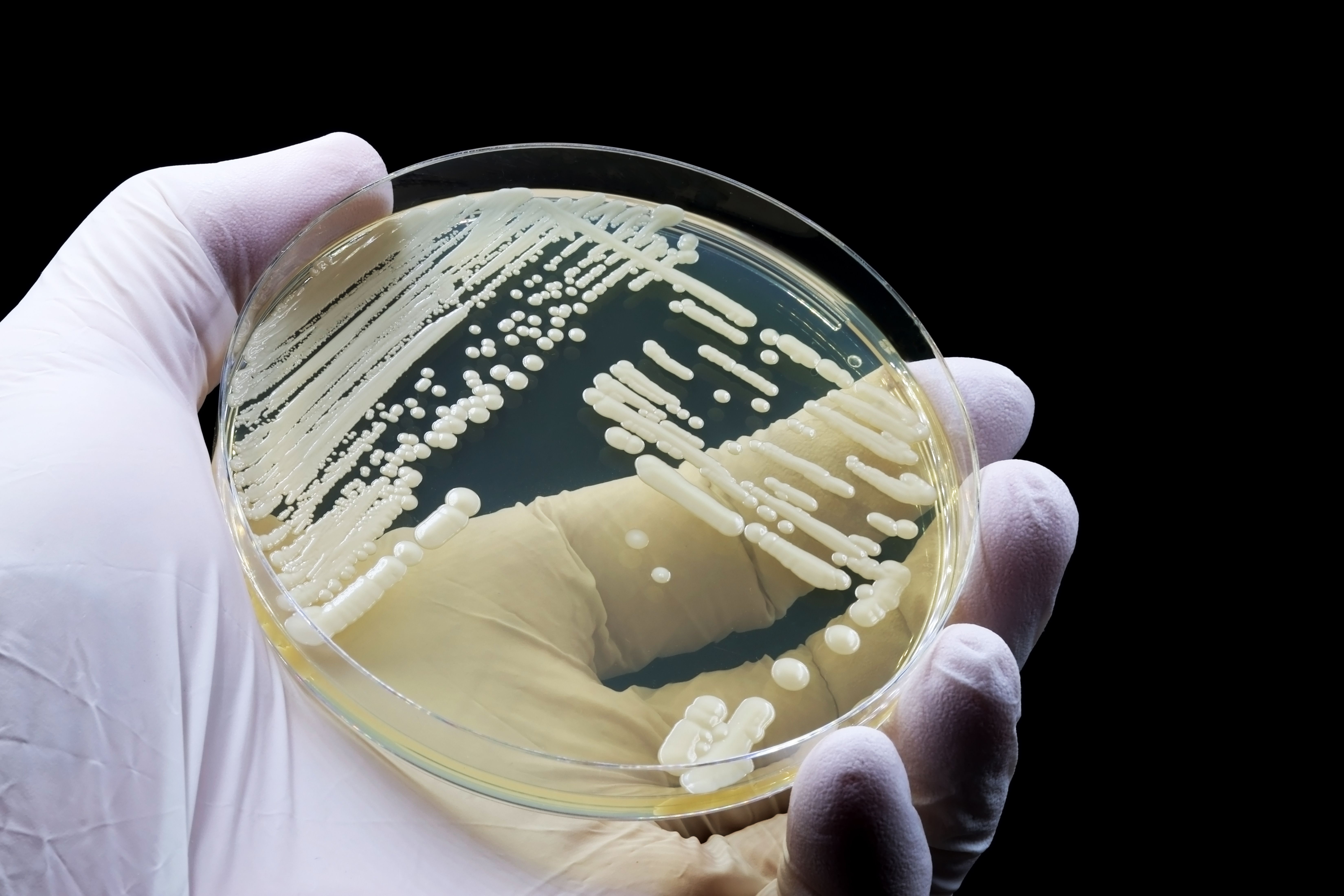 Hand of doctor or scientist showing a microbiological culture of the yeast Candida auris, responsible for urinary tract infections - Image credit: TopMicrobialStock | stock.adobe.com