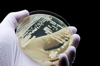 Hand of doctor or scientist showing a microbiological culture of the yeast Candida auris, responsible for urinary tract infections - Image credit: TopMicrobialStock | stock.adobe.com
