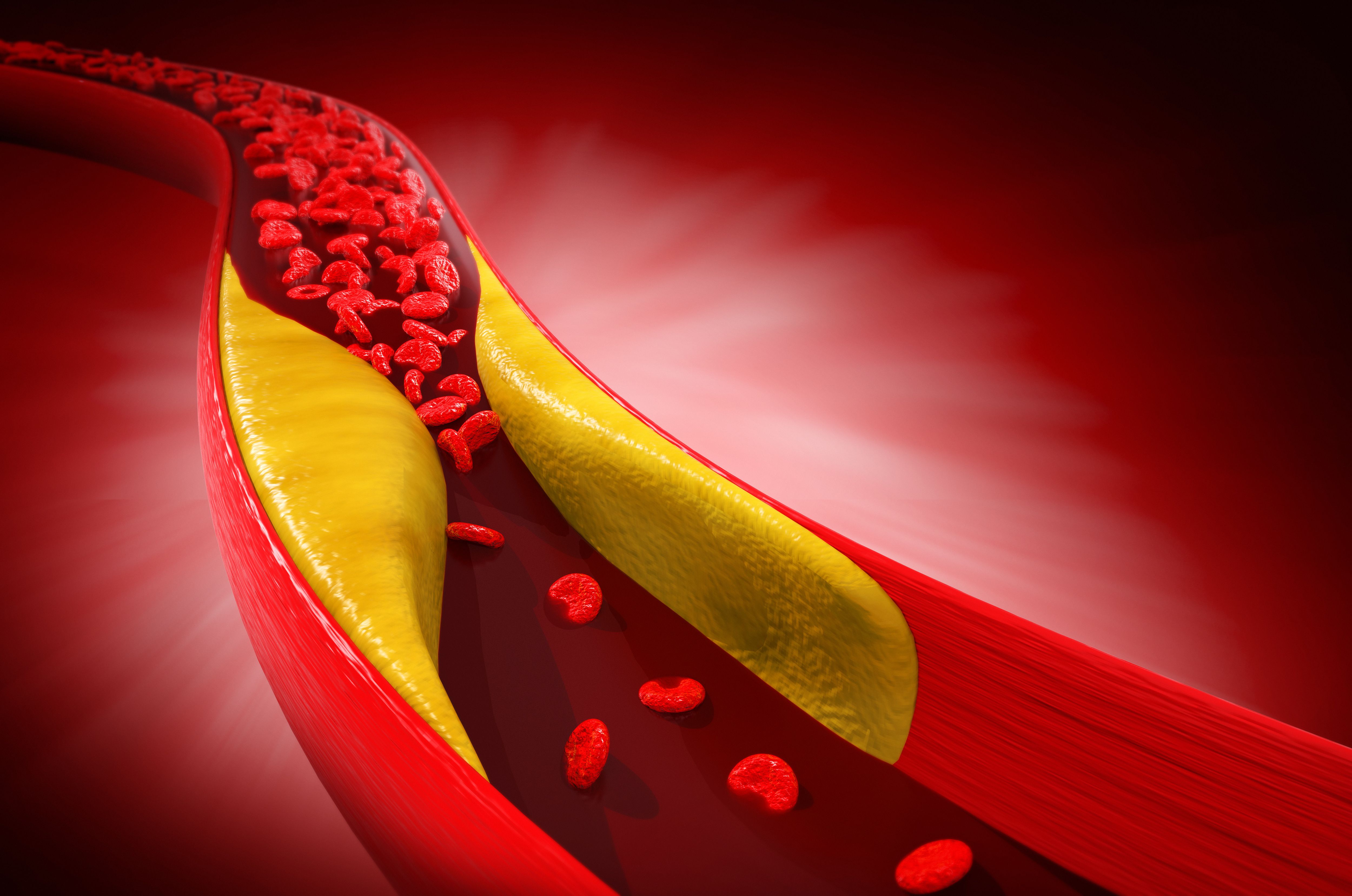 High Sensitivity C-Reactive Protein, High-Density Lipoprotein Cholesterol, All-Cause Mortality | Image Credit: SK imagine | stock.adobe.com