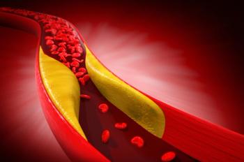 High Sensitivity C-Reactive Protein, High-Density Lipoprotein Cholesterol, All-Cause Mortality | Image Credit: SK imagine | stock.adobe.com