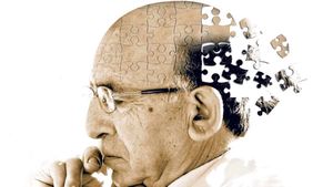 Alzheimer Disease: Current and New Advances in Treatment