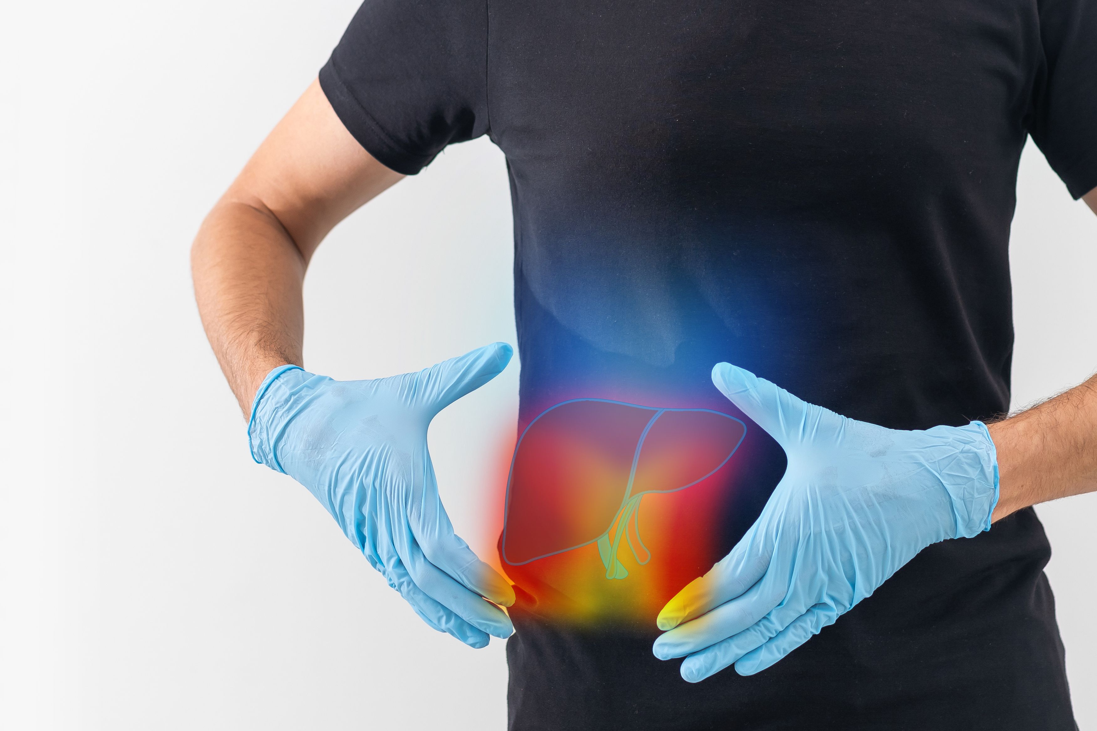 Metabolic dysfunction-associated steatohepatitis (MASH) -- Image credit: Angelov | stock.adobe.com