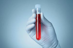 Gloved hand holding blood sample | Image Credit: © Csaba Deli - stock.adobe.com