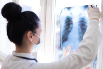Health care worker looking at lung x-ray