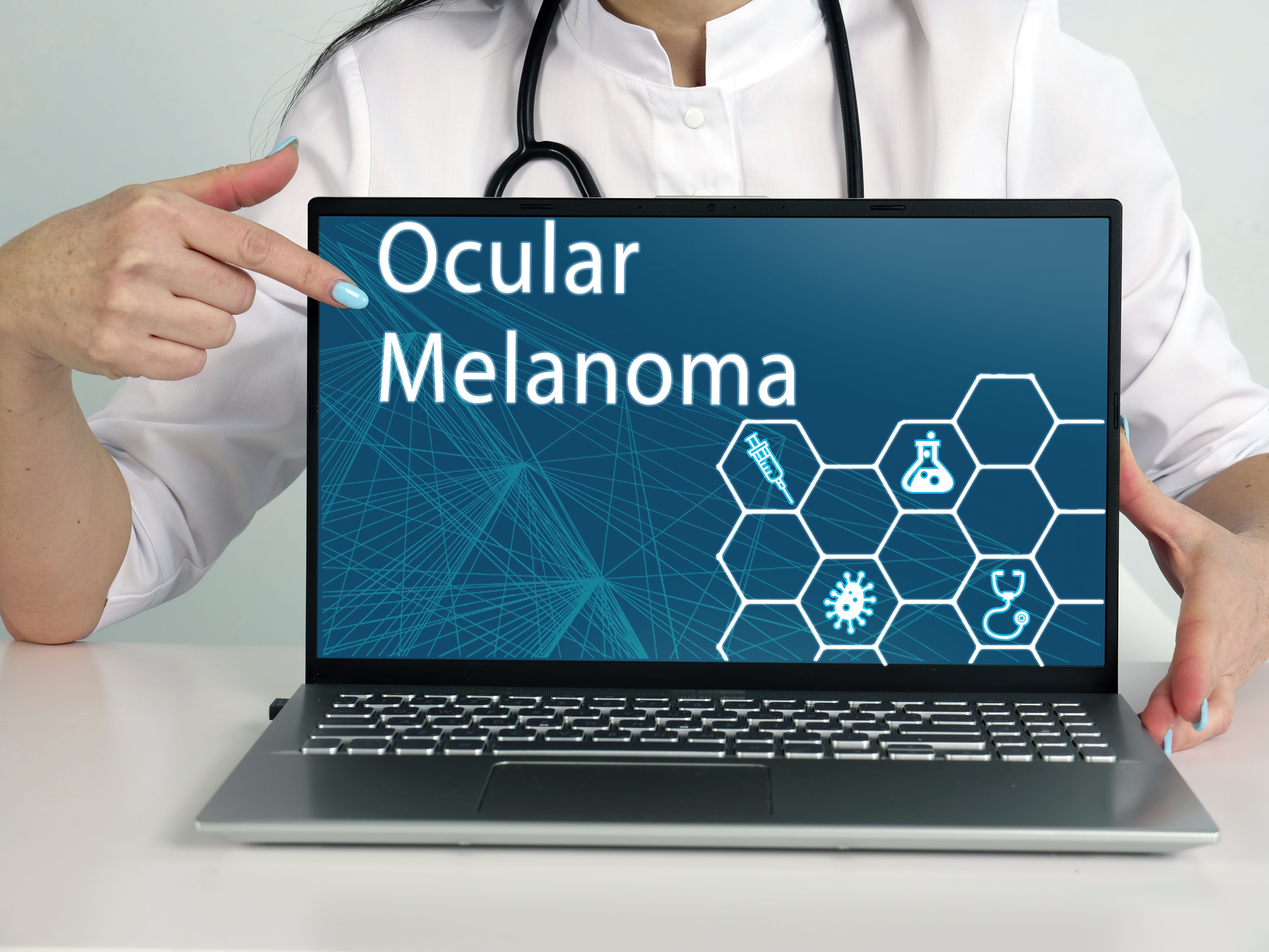 Ocular Melanoma phrase on the screen. Neurologist use cell technologies at office. | Image Credit: Yurii Kibalnik - stock.adobe.com