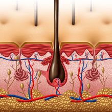 Study: Eczema Drug May Lower Risk of Death From COVID-19