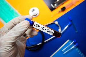 HDL-C Test with blood sample. Top view isolated on color background. Healthcare/Medical concept
