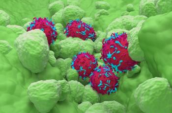Non Small Cell Lung Cancer (NSCLC) in the lung tissue - super closeup view 3d illustration