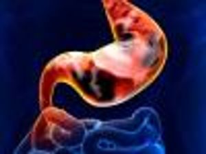 Cyramza Added to Chemo Regimen Not Found to Improve Gastric Cancer Survival