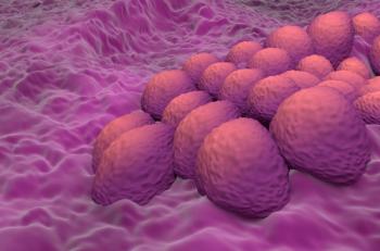 Endometrial cancer cells in the uterus or cervix | Image Credit: LASZLO - stock.adobe.com