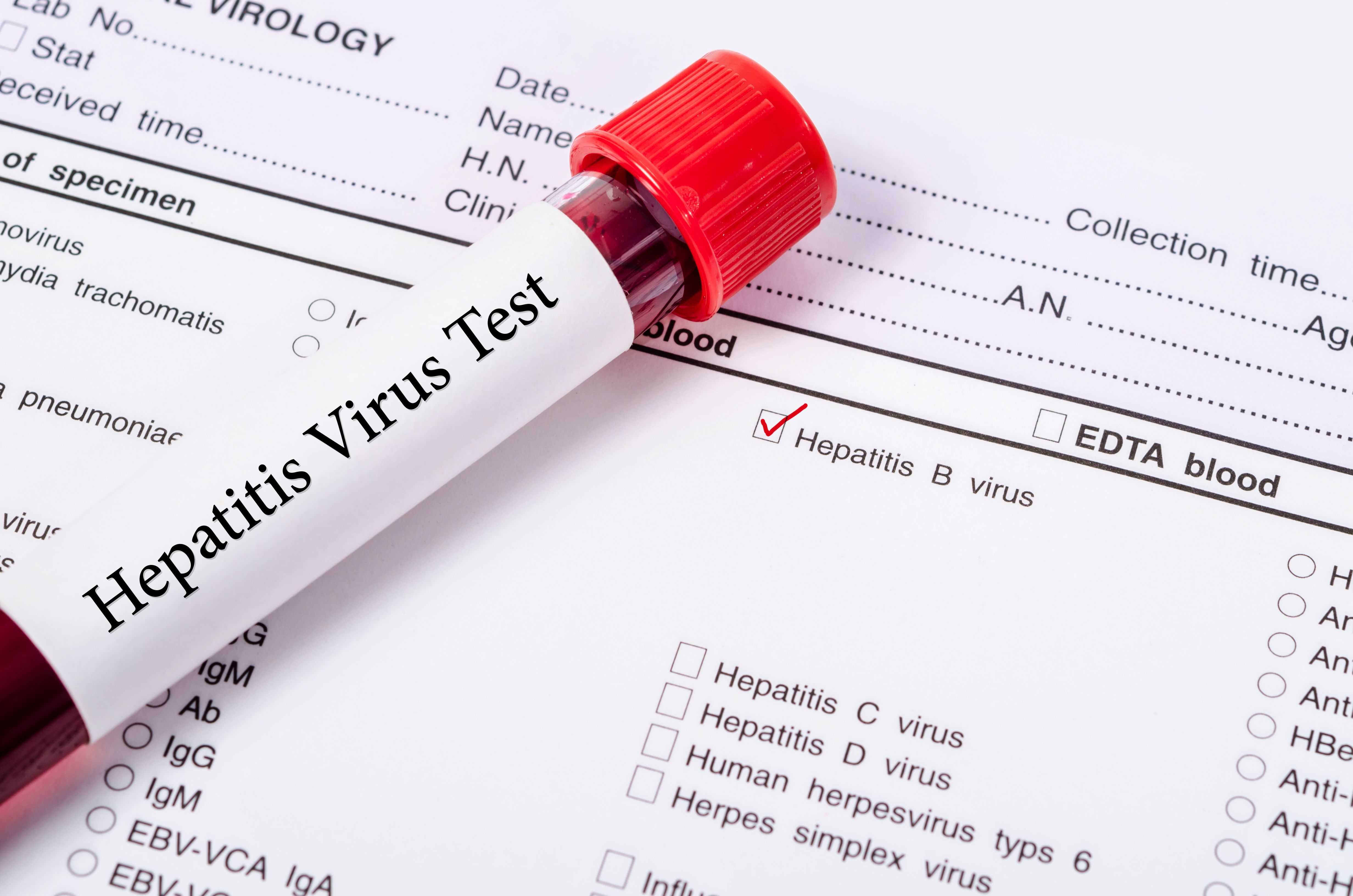 Hepatitis B virus test -- Image credit: gamjai | stock.adobe.com