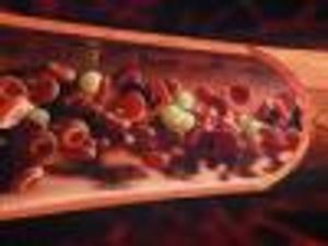 Hemophilia Drug Shows Promise in Extending Time Between Infusions