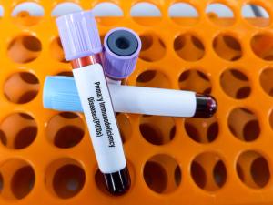 Blood sample for Primary Immunodeficiency Diseases(PIDDs) test. | Image Credit: MdBabul | stock.adobe.com