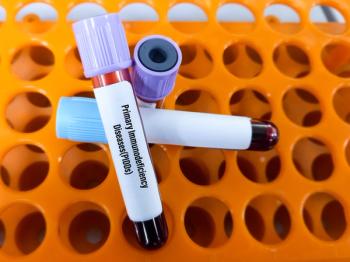 Blood sample for Primary Immunodeficiency Diseases(PIDDs) test. | Image Credit: MdBabul | stock.adobe.com
