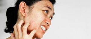 Topical Corticosteroids