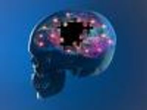 Critical Illnesses May Promote Cognitive Decline Associated With Alzheimer Disease