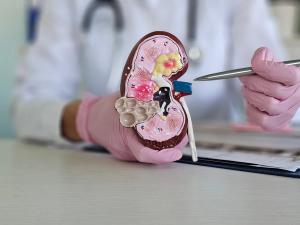 Model depicting chronic kidney disease (CKD) -- Image credit: Nadzeya | stock.adobe.com