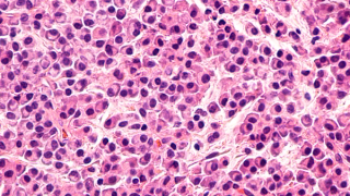 The Safety and Arterial Occlusive Events Profiles Observed With Response-based Ponatinib Dosing Regimens