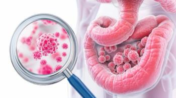 Graphic Medical Representation of Gastric Cancer