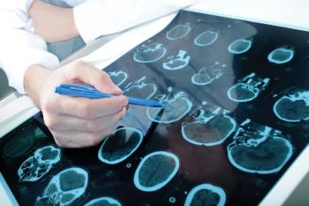 Brain scans