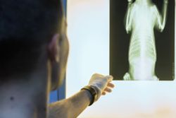 Experts Review Current Treatment Space, Future Directions in Basal Cell Carcinoma