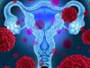 Chlamydia Linked to Increased Ovarian Cancer Risk