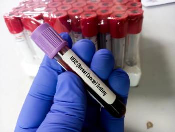 Blood sample for Her-2 breast cancer testing, human epidermal growth factor receptor 2(HER2), ERBB2 Amplification. | Image Credit: MdBabul | stock.adobe.com