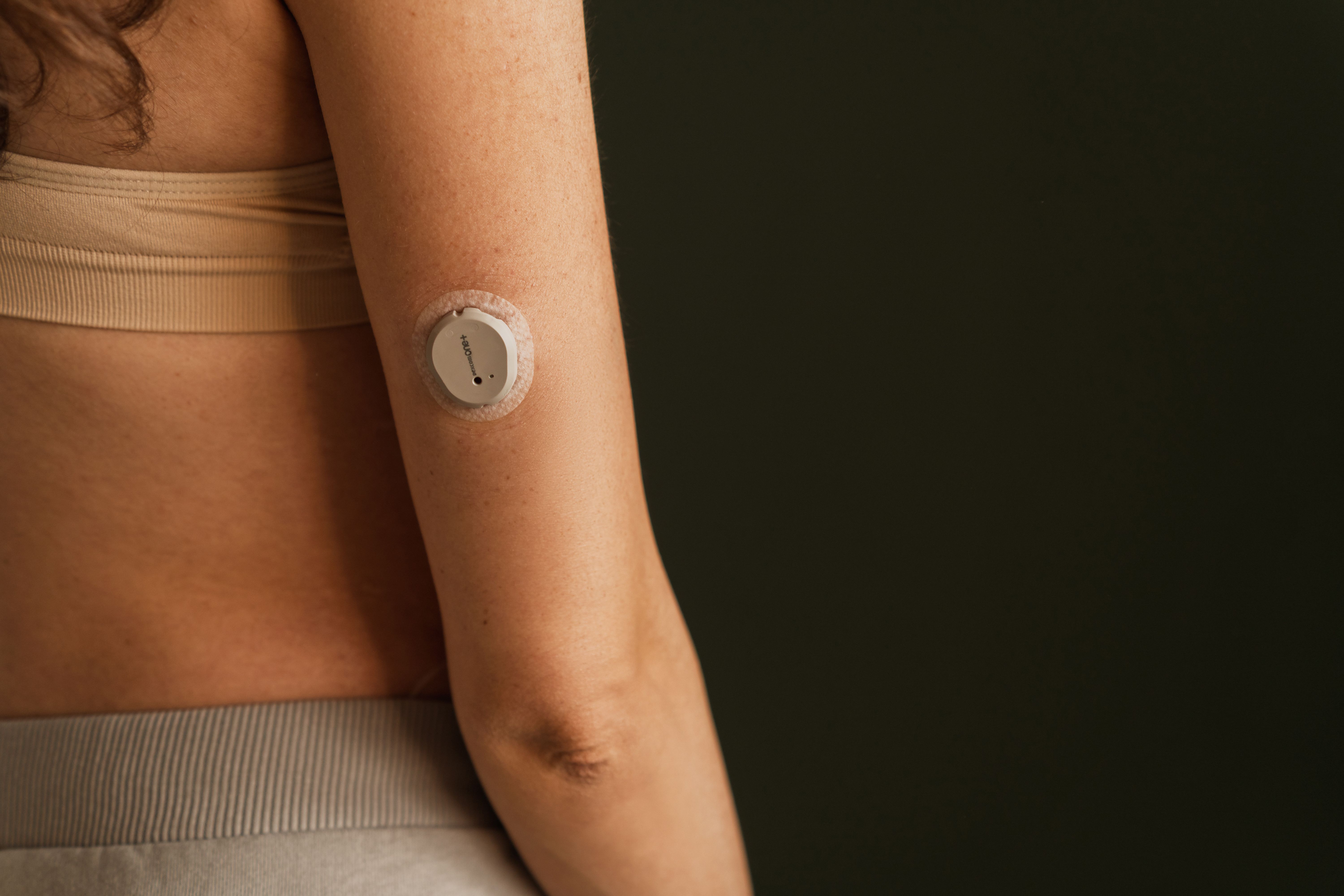 MINSK, BELARUS - MARCH 11, 2025: blood sugar monitor on her arm. Dexcom One Plus. Life with diabetes - Image credit: Dulin | stock.adobe.com