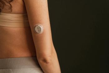 MINSK, BELARUS - MARCH 11, 2025: blood sugar monitor on her arm. Dexcom One Plus. Life with diabetes - Image credit: Dulin | stock.adobe.com