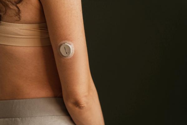 MINSK, BELARUS - MARCH 11, 2025: blood sugar monitor on her arm. Dexcom One Plus. Life with diabetes - Image credit: Dulin | stock.adobe.com