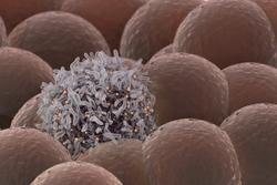 Defining Oligometastatic Disease Vital to Support Interpretation of Breast Cancer Trial Results