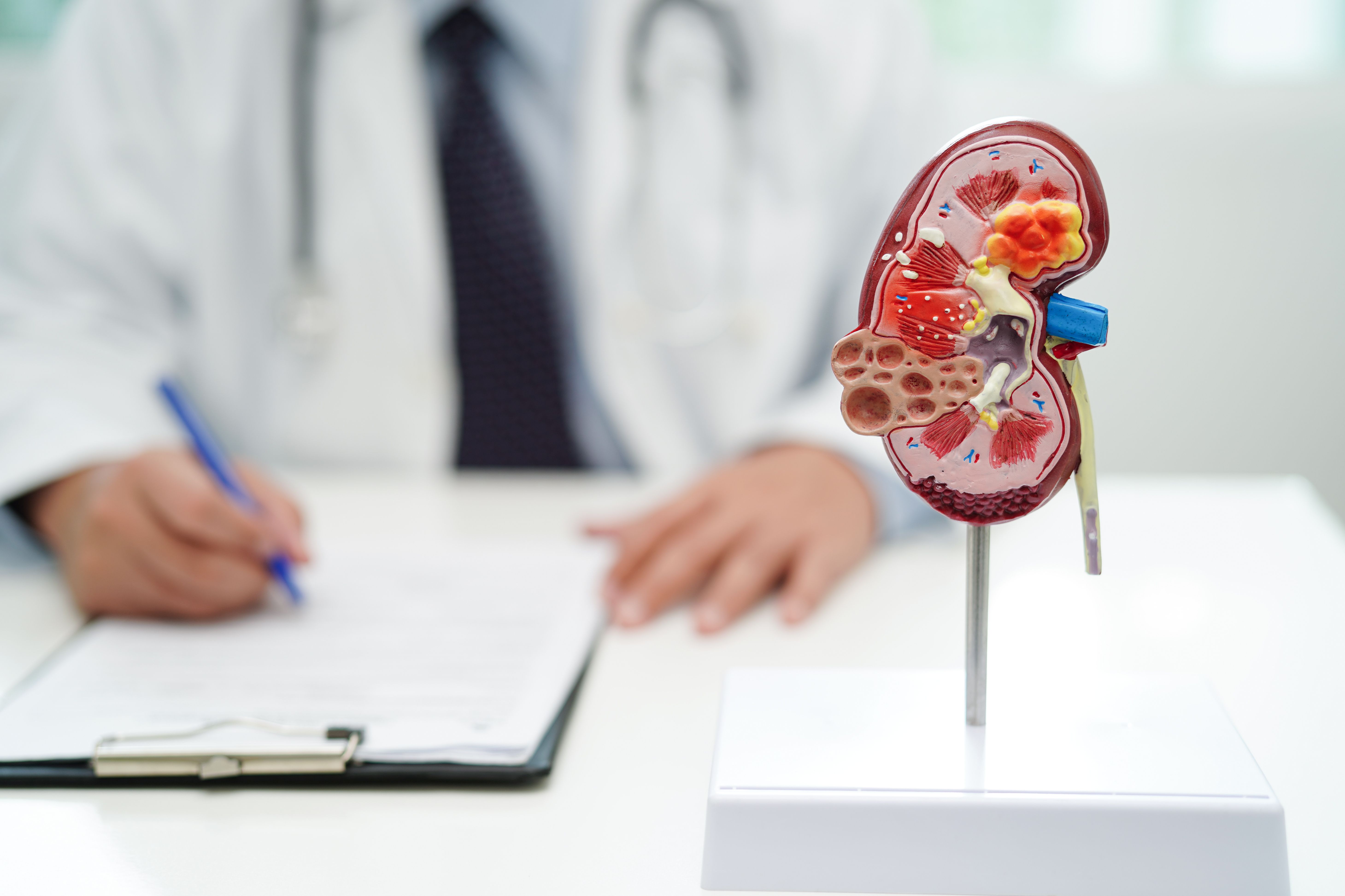 Health care professional and model of a kidney -- Image credit: manassanant | stock.adobe.com