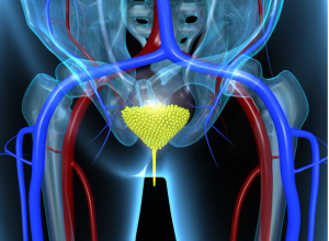 Treatment of Acute, Uncomplicated Urinary Tract Infections with Ampicillin for Vancomycin-Resistant Enterococcus Species