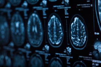 Scan of brain -- Image credit: merydolla | stock.adobe.com