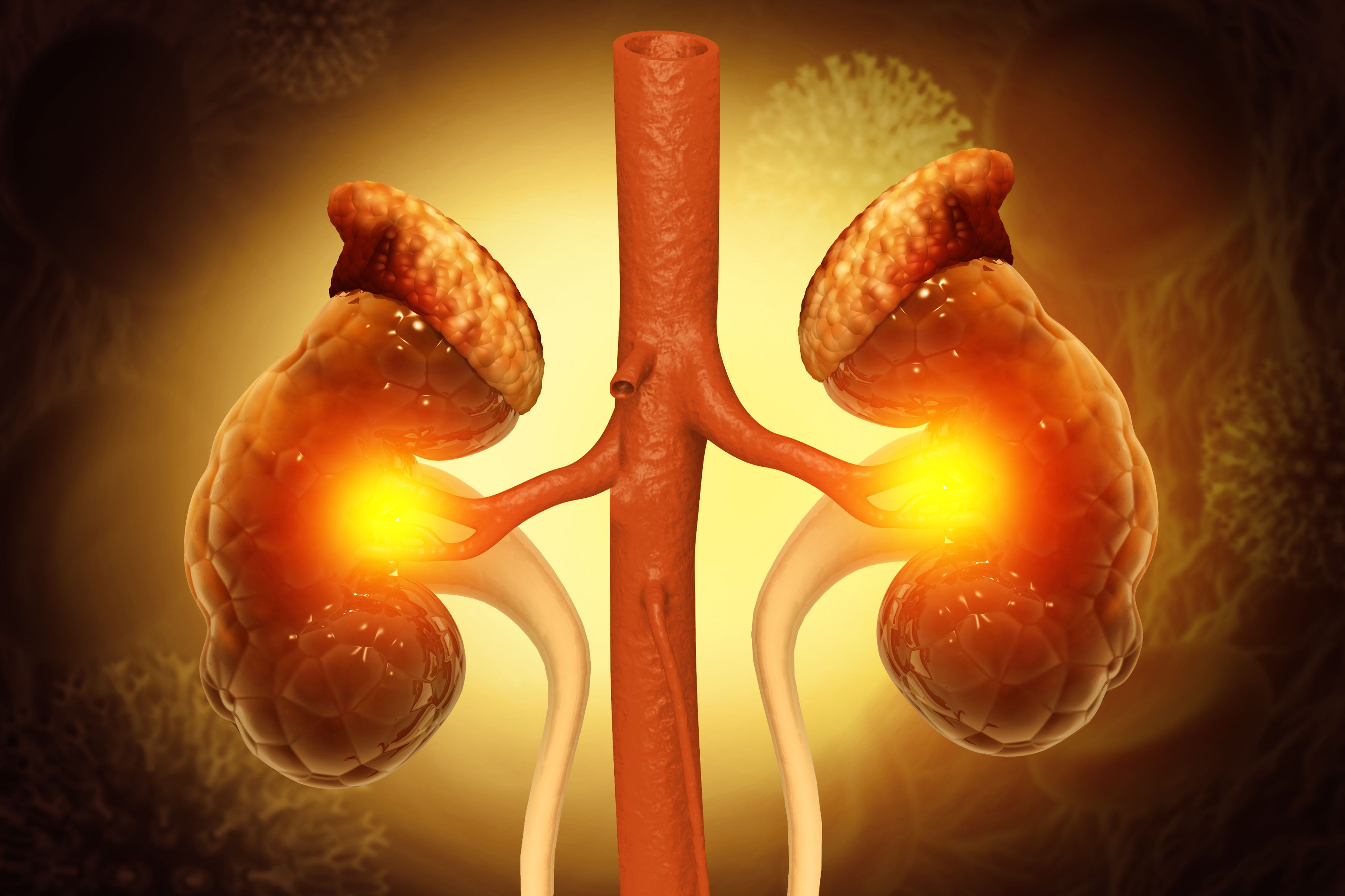 Kidneys affected by chronic kidney disease (CKD) -- Image credit: Crystal light | stock.adobe.com